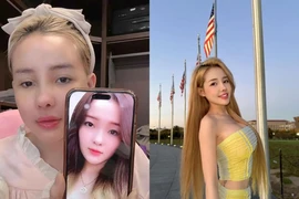 Ngân 98 lộ diện mạo sau 3 tháng phẫu thuật thẩm mỹ