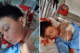 Thực hư chuyện bố đẻ đánh và dội nước sôi lên người bé trai 8 tuổi?