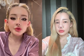 Ngân 98 tiết lộ phải nhập viện... do nhiễm trùng nặng