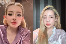 Ngân 98 tiết lộ phải nhập viện... do nhiễm trùng nặng