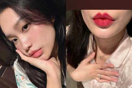 "Zoom" kỹ đôi môi của vợ Đoàn Văn Hậu sau thẩm mỹ