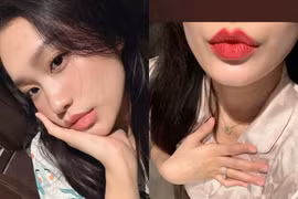 "Zoom" kỹ đôi môi của vợ Đoàn Văn Hậu sau thẩm mỹ