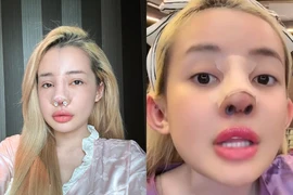 "Nghiện" phẫu thuật thẩm mỹ, Ngân 98 lại chuẩn bị "đập đi xây lại"