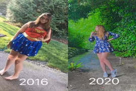 Nặng gần 100kg, cô gái 10X giảm cân đẹp như búp bê Barbie