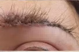 Cấy lông mày người phụ nữ nhận cái kết đáng sợ