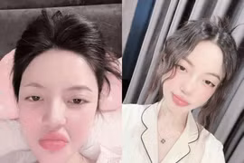 Xài app quá lố, vợ Quang Hải lộ gương mặt "biến dạng"