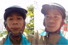 Đi sửa mạng, anh chàng môi sưng tều vì gặp phải "đối thủ" này