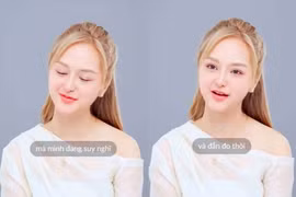 Gấm Kami hé lộ về lộ trình tiếp tục phẫu thuật thẩm mỹ 