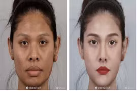 Lộ thủ thuật hot girl mạng ngày một nhiều như "nấm sâu mưa"