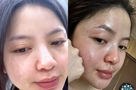 Vợ Quang Hải liên tục xuất hiện với thần sắc kém, lộ khuyết điểm