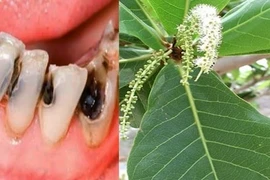 Lá bàng đun nóng: Hiệu quả từ đau răng, nhiệt miệng đến... viêm vùng kín 