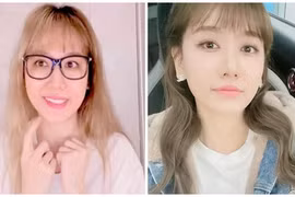 Sau ồn ào bị liệt cơ mặt, Hari Won giờ thế nào?