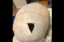 Khai quật nghĩa địa cổ, rùng mình hộp sọ bị khoan lỗ 3.200 tuổi 