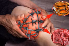 Trời lạnh, bệnh xương khớp cần tuyệt đối tránh 7 thực phẩm này 