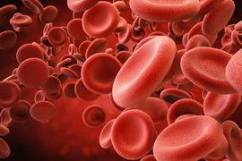 Nhóm máu nào có nguy cơ mắc đột quỵ cao nhất?