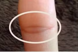 Người có vân tay 'mắt phật' này có duyên với Thần tài