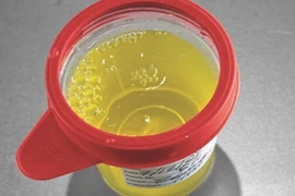 Nam giới thấy có 3 đặc điểm này nghĩa là thận đang rất khỏe mạnh