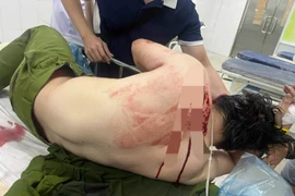 Vào nhà thờ công giáo gây rối rồi dùng dao đâm 2 cán bộ công an