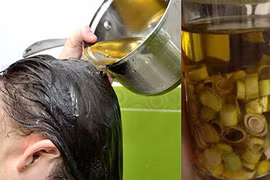 Video: Chữa tóc rụng kinh niên sau 1 lần gội
