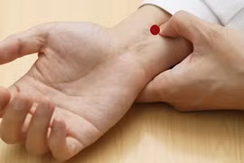 Video: 8 huyệt vị là chìa khóa cứu mạng người lúc nguy nan