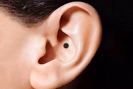 Video: Nốt ruồi ở tai là họa hay phúc?