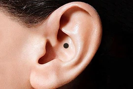 Video: Nốt ruồi ở tai là họa hay phúc?