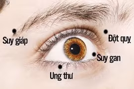 Video: Nếu mắt bạn có 1 trong 8 dấu hiệu này, đừng bao giờ bỏ qua!