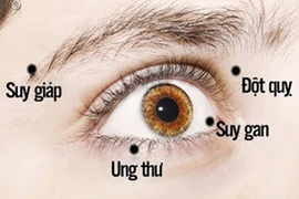 Video: Nếu mắt bạn có 1 trong 8 dấu hiệu này, đừng bao giờ bỏ qua!