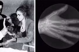 9 sự thật kỳ quặc chứng minh cơ thể người đầy bí ẩn 