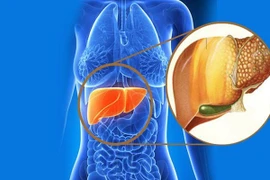 Vì sao người gầy vẫn có nguy cơ mắc gan nhiễm mỡ?