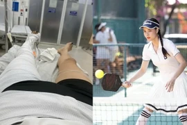 Kỳ Hân gãy chân khi chơi pickleball, cách phòng tránh chấn thương