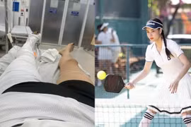Kỳ Hân gãy chân khi chơi pickleball, cách phòng tránh chấn thương