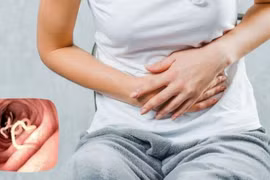 Dấu hiệu "âm thầm" cảnh báo cơ thể đang chứa đầy giun, cần tẩy gấp