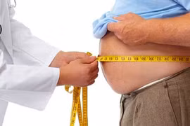 Tự chữa gout, người đàn ông tăng cân không kiểm soát