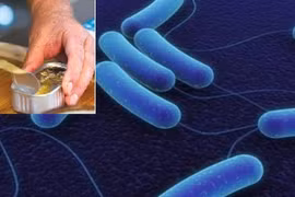 Nam thanh niên liệt tứ chi sau khi ăn pate đóng hộp bảo quản sai cách