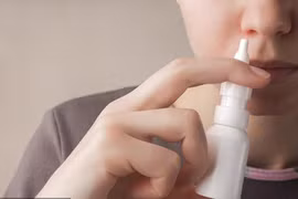 Lạm dụng thuốc xịt mũi chữa viêm xoang, người phụ nữ mắc suy thượng thận