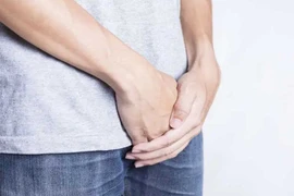 Mắc u mềm lây sau nhiều lần quan hệ tình dục không an toàn