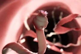 Thói quen ăn uống “mở đường” cho sán vào người, ít ai để ý