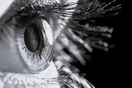 Suýt mù vì hóa chất chảy vào mắt khi uốn mi