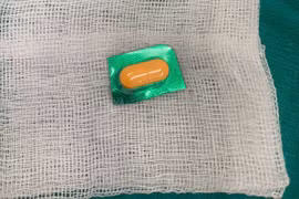 Viên thuốc còn nguyên vỏ sắc nhọn trong thực quản bệnh nhân 33 tuổi