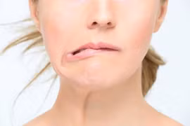 Bị liệt dây thần kinh số 7 có nguy hiểm?