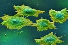 3 loại thực phẩm giàu tính kiềm là thiên địch của ung thư