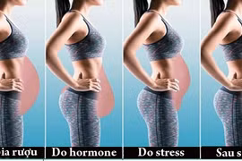 3 bài tập giúp giảm mỡ thừa cho từng kiểu béo bụng