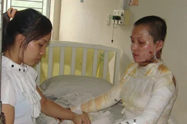 Cháy đen người vì nổi lửa khi quần áo dính... xăng