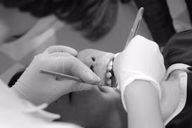 Nắn chỉnh răng bằng mắc cài mặt lưỡi 