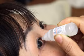 Thời kỳ mãn kinh dễ bị... khô mắt