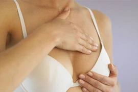 Phân biệt u nang và u xơ