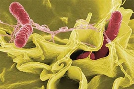 Nhận biết vi khuẩn "ăn ruột" cực kỳ nguy hiểm