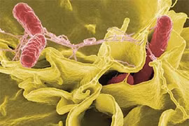 Nhận biết vi khuẩn "ăn ruột" cực kỳ nguy hiểm