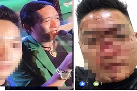 Fan minh oan cho Chiến Thắng vụ kêu vệ sĩ đánh khán giả 